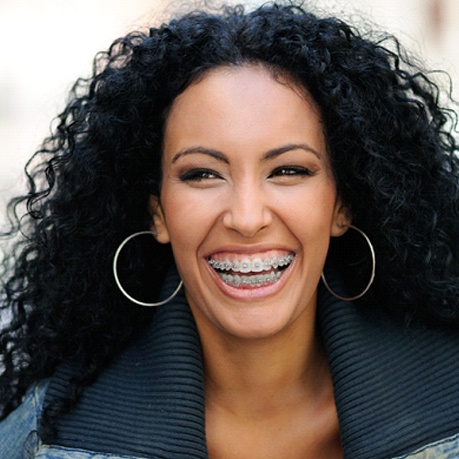 A woman with long, dark, curly hair smiles while showing off her LightForce 3D Printed Ceramic Braces