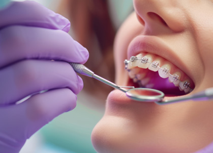 Close-up of patient’s mouth during exam