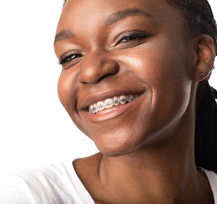 Are Braces Expensive? How can you Plan for The Cost of Braces