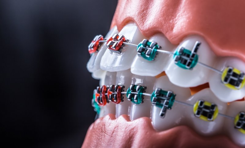 up-close view of braces on a mouth mold 